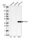 Replication Termination Factor 2 antibody, HPA053986, Atlas Antibodies, Western Blot image 