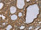 E3 ubiquitin-protein ligase RNF5 antibody, CSB-PA345004, Cusabio, Immunohistochemistry paraffin image 