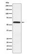 Leucine Rich Glioma Inactivated 1 antibody, M00850, Boster Biological Technology, Western Blot image 