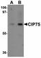 Ubiquilin-4 antibody, LS-C108556, Lifespan Biosciences, Western Blot image 