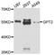 Glutamic--Pyruvic Transaminase 2 antibody, A11819, ABclonal Technology, Western Blot image 