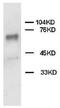 Protein Tyrosine Phosphatase Non-Receptor Type 11 antibody, AP23324PU-N, Origene, Western Blot image 