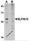 Schlafen Family Member 12 antibody, 5539, ProSci, Western Blot image 