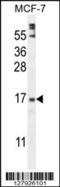 Zinc Finger Protein 720 antibody, 55-567, ProSci, Western Blot image 