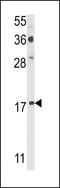 P53 And DNA Damage Regulated 1 antibody, GTX81627, GeneTex, Western Blot image 