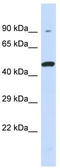 Killer cell immunoglobulin-like receptor 3DL1 antibody, TA346437, Origene, Western Blot image 