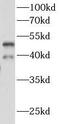 Rh Blood Group D Antigen antibody, FNab10000, FineTest, Western Blot image 