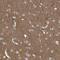 P2RX7 antibody, HPA034968, Atlas Antibodies, Immunohistochemistry paraffin image 