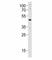 Pancreas/duodenum homeobox protein 1 antibody, F53050-0.4ML, NSJ Bioreagents, Western Blot image 