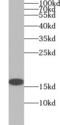 Cyclin-dependent kinase inhibitor 2A, isoforms 1/2/3 antibody, FNab06064, FineTest, Western Blot image 
