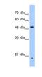 Zinc Finger DHHC-Type Containing 16 antibody, NBP1-59446, Novus Biologicals, Western Blot image 