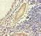 Huntingtin Interacting Protein M antibody, LS-C396295, Lifespan Biosciences, Immunohistochemistry paraffin image 