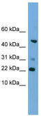 Rac Family Small GTPase 1 antibody, TA344596, Origene, Western Blot image 