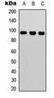 BCL6 Transcription Repressor antibody, LS-C368565, Lifespan Biosciences, Western Blot image 
