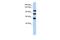 Protein Phosphatase 1 Regulatory Subunit 13B antibody, PA5-43120, Invitrogen Antibodies, Western Blot image 