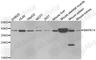 p38 antibody, A0227, ABclonal Technology, Western Blot image 