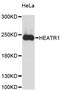 HEAT repeat-containing protein 1 antibody, LS-C748163, Lifespan Biosciences, Western Blot image 