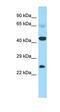 Calcium Binding Protein, Spermatid Associated 1 antibody, orb326741, Biorbyt, Western Blot image 