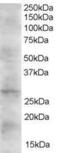 Dickkopf WNT Signaling Pathway Inhibitor 2 antibody, GTX41187, GeneTex, Western Blot image 