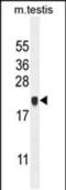 Chromosome 4 Open Reading Frame 46 antibody, PA5-48136, Invitrogen Antibodies, Western Blot image 