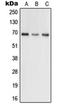 G Protein-Coupled Receptor Kinase 5 antibody, orb214003, Biorbyt, Western Blot image 