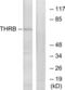 F2 antibody, LS-C118750, Lifespan Biosciences, Western Blot image 