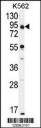 Protein Phosphatase 1 Regulatory Subunit 21 antibody, 55-684, ProSci, Western Blot image 