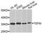 Transcription Elongation Factor, Mitochondrial antibody, A8511, ABclonal Technology, Western Blot image 