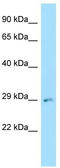 Endoplasmic reticulum-Golgi intermediate compartment protein 2 antibody, TA335552, Origene, Western Blot image 