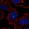 Hensin antibody, HPA040778, Atlas Antibodies, Immunofluorescence image 