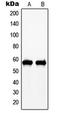 c-Myc antibody, LS-C352578, Lifespan Biosciences, Western Blot image 
