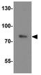 Solute Carrier Organic Anion Transporter Family Member 1B1 antibody, GTX31621, GeneTex, Western Blot image 