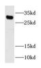 Histone H1t antibody, FNab03875, FineTest, Western Blot image 