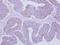 Phosphorylase Kinase Regulatory Subunit Alpha 2 antibody, LS-C185976, Lifespan Biosciences, Immunohistochemistry paraffin image 