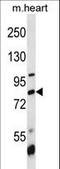 Bromodomain Containing 7 antibody, LS-C156858, Lifespan Biosciences, Western Blot image 