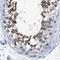 Dynein Axonemal Intermediate Chain 1 antibody, NBP1-84465, Novus Biologicals, Immunohistochemistry paraffin image 