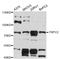 Transient Receptor Potential Cation Channel Subfamily V Member 2 antibody, abx126742, Abbexa, Western Blot image 