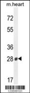 Beta-1,3-Glucuronyltransferase 2 antibody, 55-199, ProSci, Western Blot image 