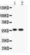Protein Inhibitor Of Activated STAT 4 antibody, PA2215, Boster Biological Technology, Western Blot image 