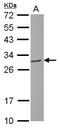6-Phosphogluconolactonase antibody, NBP2-19785, Novus Biologicals, Western Blot image 
