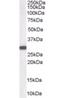 NAD(P)H Quinone Dehydrogenase 1 antibody, orb66484, Biorbyt, Western Blot image 