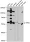 Inositol Hexakisphosphate Kinase 1 antibody, GTX64396, GeneTex, Western Blot image 