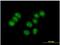 Zinc Finger Protein 554 antibody, H00115196-B01P-50ug, Novus Biologicals, Immunocytochemistry image 