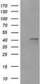 Parvin Alpha antibody, CF505993, Origene, Western Blot image 
