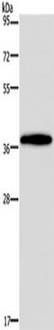 Homeobox protein DLX-4 antibody, TA349895, Origene, Western Blot image 