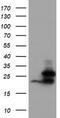 Ubiquitin Conjugating Enzyme E2 E3 antibody, TA800065, Origene, Western Blot image 