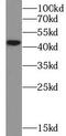 Cathepsin E antibody, FNab10702, FineTest, Western Blot image 