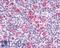 C-C Motif Chemokine Receptor 9 antibody, LS-A961, Lifespan Biosciences, Immunohistochemistry frozen image 