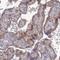 Multivesicular Body Subunit 12B antibody, PA5-60468, Invitrogen Antibodies, Immunohistochemistry frozen image 