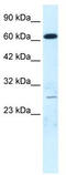 Mediator Complex Subunit 17 antibody, TA335753, Origene, Western Blot image 